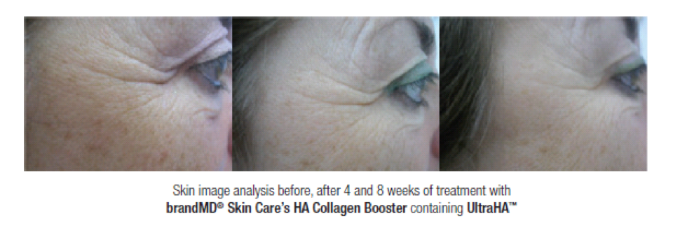 Ha Collagen Booster Available From Brandmd Practical Dermatology