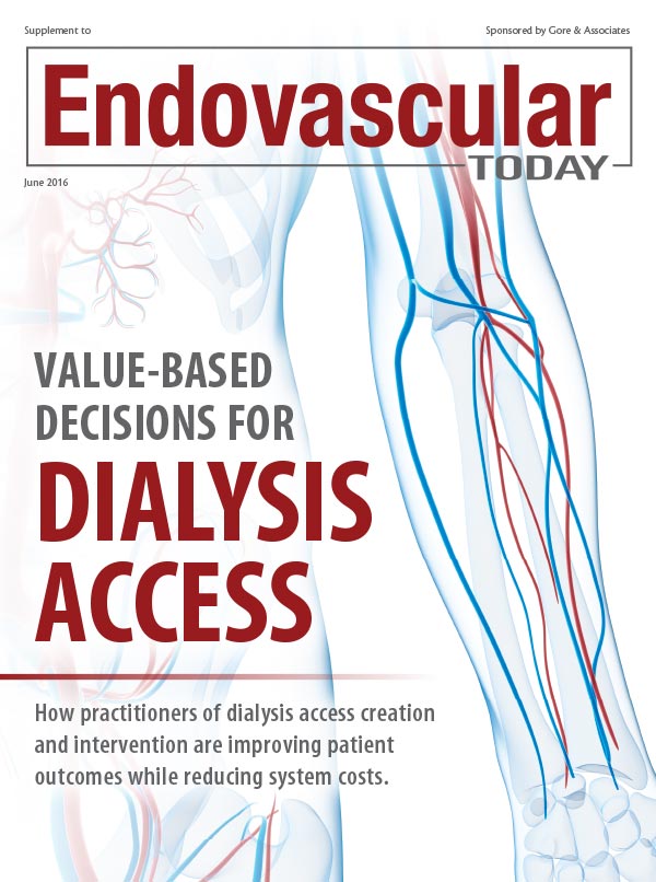 Treating Disadvantaged Venous Anatomy With the GORE® Hybrid Vascular ...